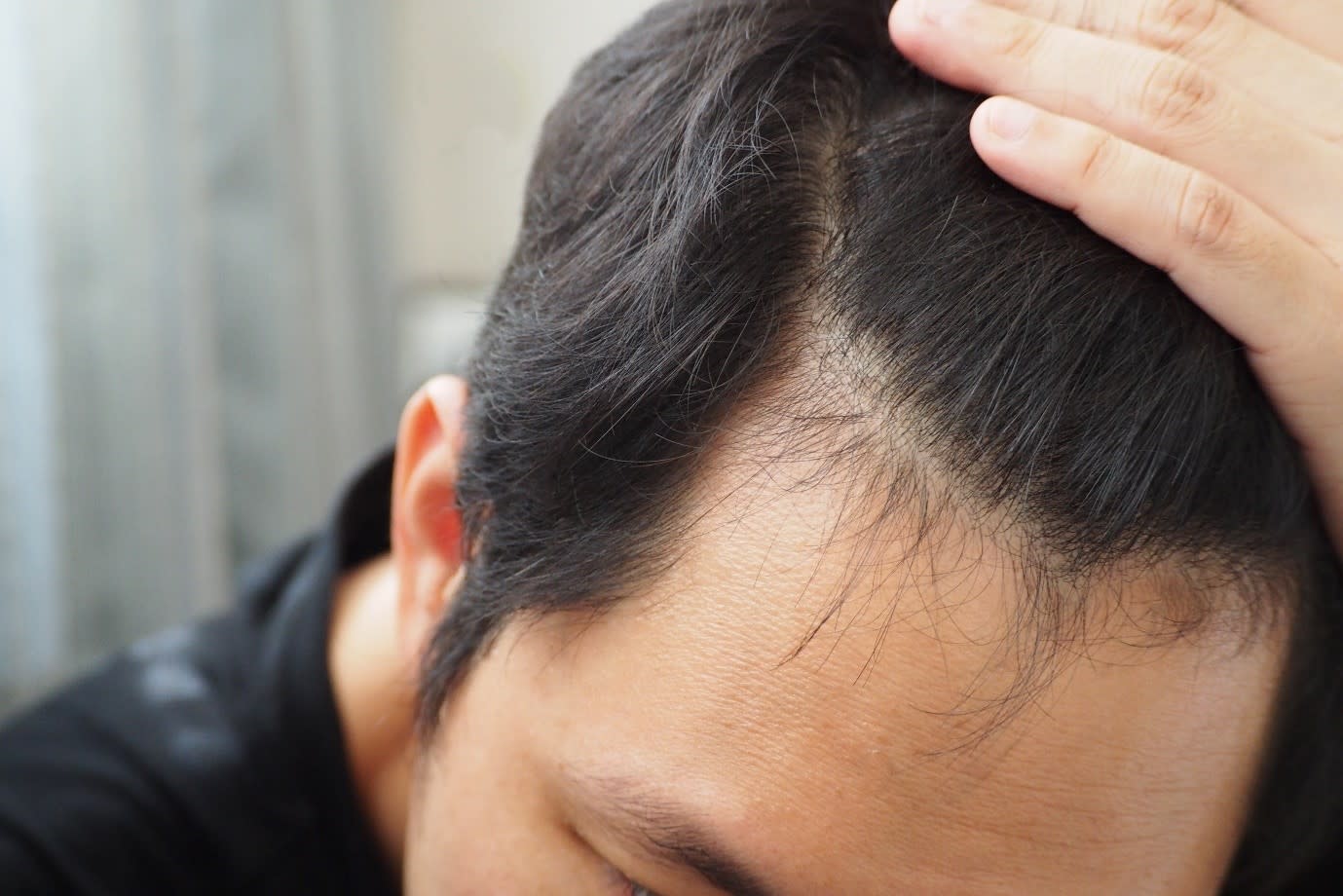 The Best Hair Care Tips for Men with Sensitive Scalps